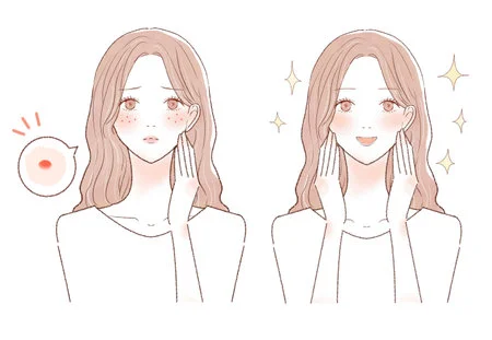 口服A酸會產生哪些副作用?